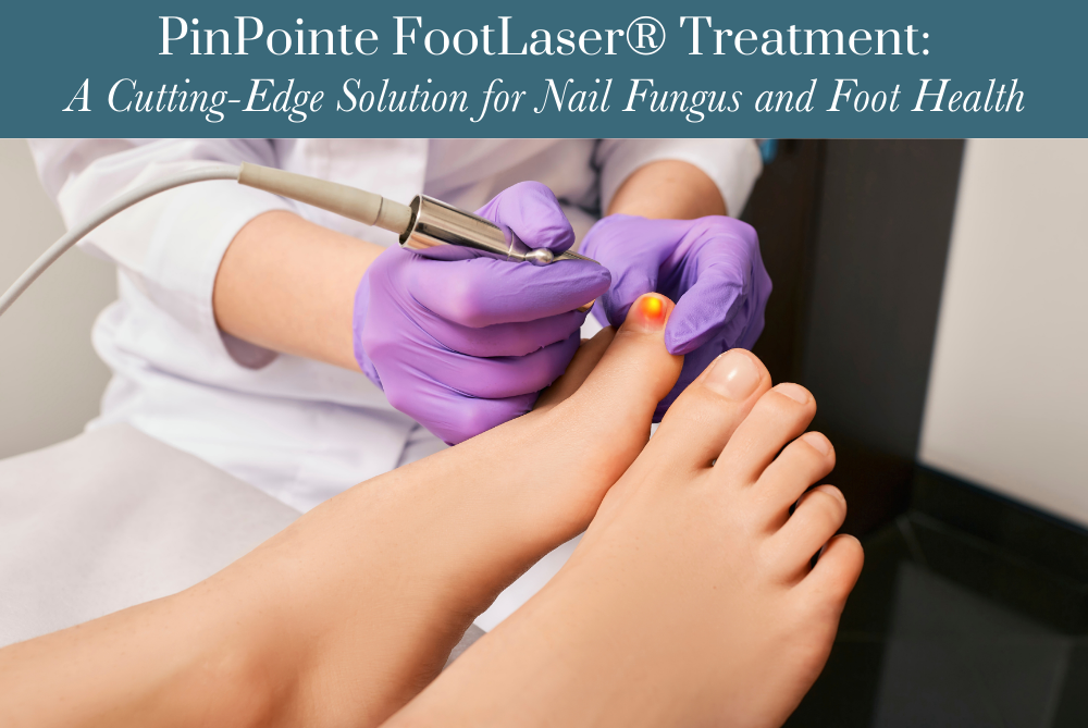 PinPointe FootLaser® Treatment A Cutting-Edge Solution for Nail Fungus and Foot Health