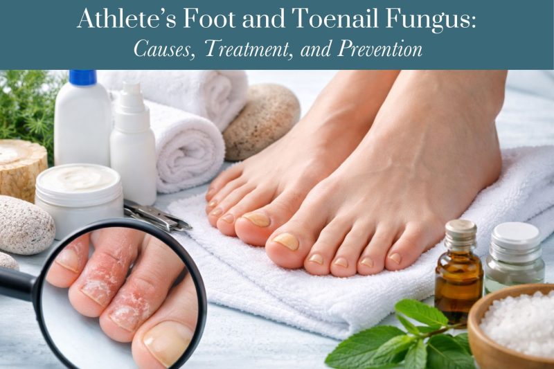 Athlete’s Foot and Toenail Fungus: Causes, Treatment, and Prevention