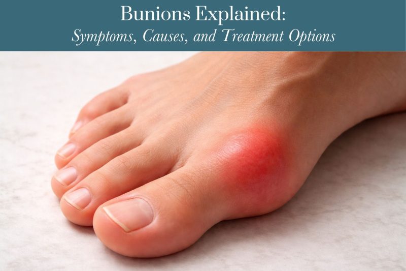 Bunions Explained Symptoms, Causes, and Treatment Options