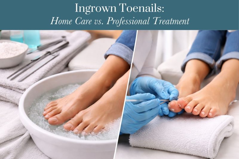 Ingrown Toenails: Home Care vs. Professional Treatment