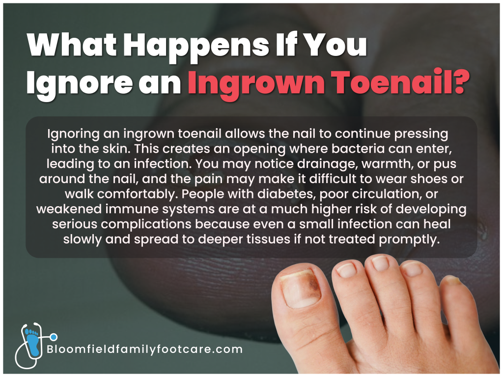 Ingrown Toenail