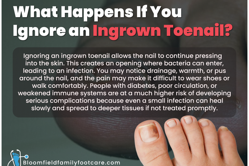 Ingrown Toenail